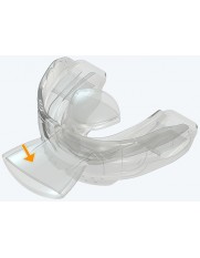 MyOSA Myotalea® Tongue, Lip & Jaw Appliance - TLJ